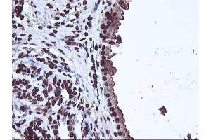Immunohistochemical staining of paraffin-embedded Human breast tissue using anti-OSGEP mouse monoclonal antibody. (OSGEP 抗体  (AA 1-335))