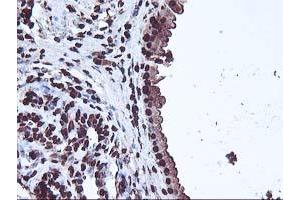 Immunohistochemical staining of paraffin-embedded Human breast tissue using anti-OSGEP mouse monoclonal antibody.