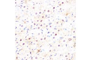 Immunohistochemistry of paraffin-embedded rat ovary using DP1/TFDP1 Rabbit mAb (ABIN7270891) at dilution of 1:100 (40x lens). (DP1 抗体)