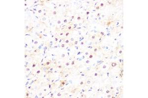 Immunohistochemistry of paraffin-embedded rat ovary using DP1/TFDP1 Rabbit mAb (ABIN7270891) at dilution of 1:100 (40x lens). (DP1 抗体)
