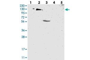 Western blot analysis of Lane 1: RT-4, Lane 2: U-251 MG, Lane 3: Human Plasma, Lane 4: Liver, Lane 5: Tonsil with USP36 polyclonal antibody  at 1:250-1:500 dilution. (USP36 抗体)