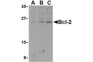 Western blot analysis of Bcl-2 in Daudi cell lysates with AP30128PU-N Bcl-2 antibody at (A) 1, (B) 2, and (C) 4 μg/ml. (Bcl-2 抗体  (N-Term))