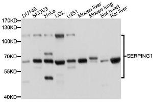 Western blot analysis of extracts of various cell lines, using SERPING1 antibody.