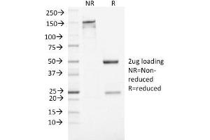 SDS-PAGE Analysis Purified NSE gamma Mouse Monoclonal Antibody (ENO2/1462). (ENO2/NSE 抗体  (AA 416-433))