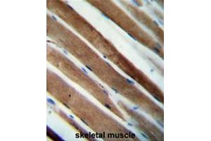 CCDC38 Antibody (Center) immunohistochemistry analysis in formalin fixed and paraffin embedded human skeletal muscle followed by peroxidase conjugation of the secondary antibody and DAB staining. (CCDC38 抗体  (Middle Region))