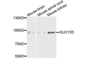 Western blot analysis of extracts of various cells, using GUCY2D antibody. (GUCY2D 抗体)