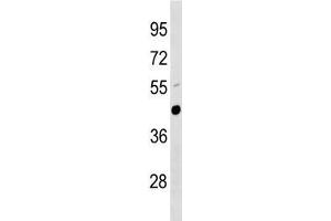Urokinase antibody western blot analysis in mouse lung tissue lysate. (PLAU 抗体  (AA 304-331))
