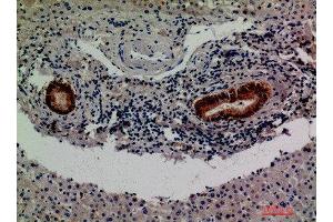 Immunohistochemical analysis of paraffin-embedded human-liver, antibody was diluted at 1:200 (F13B 抗体  (Internal Region))
