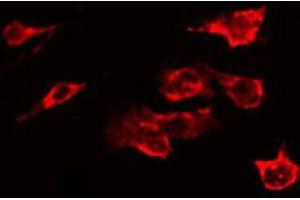 Immunofluorescence (fixed cells) (IF/ICC) image for anti-Glutamate Receptor, Ionotropic, N-Methyl D-Aspartate 2B (GRIN2B) (pTyr1336) antibody (ABIN6256636)