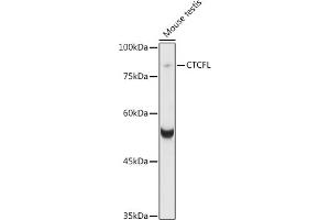 Western blot analysis of extracts of various cell lines, using CTCFL antibody (ABIN6131039, ABIN6139183, ABIN6139185 and ABIN6221755) at 1:1000 dilution. (CTCFL 抗体  (AA 1-270))