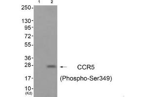 Western blot analysis of extracts from A549 cells (Lane 2), using CCR5 (Phospho-Ser349) Antibody. (CCR5 抗体  (pSer349))