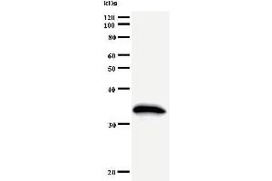 Western Blotting (WB) image for anti-General Transcription Factor IIH, Polypeptide 2, 44kDa (GTF2H2) antibody (ABIN930961) (GTF2H2 抗体)