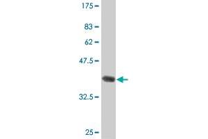Western Blot detection against Immunogen (36. (HAGH 抗体  (AA 161-260))