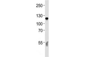 Western blot analysis of lysate from human blood plasma tissue lysate using C6 antibody diluted at 1:1000 for each lane. (C6 抗体  (AA 30-58))