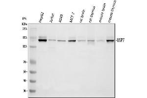 Western blot analysis of HAUSP/USP7 using anti-HAUSP/USP7 antibody (ABIN5693267). (USP7 抗体  (AA 258-483))