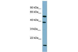 Western Blotting (WB) image for anti-Solute Carrier Family 10 (Sodium/bile Acid Cotransporter Family), Member 1 (SLC10A1) (Middle Region) antibody (ABIN2777141)