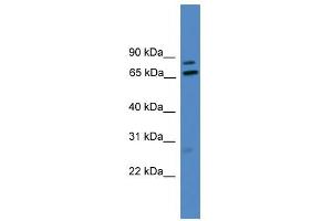 WB Suggested Anti-LRRFIP1 Antibody Titration: 0. (LRRFIP1 抗体  (Middle Region))