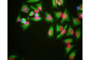 HeLa cells grown in tissue culture and stained with ABIN1580427 (red), chicken polyclonal antibody to Vimentin CPCA-VIM (green) and DNA (blue). (HMGB1 抗体)