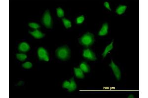 Immunofluorescence of purified MaxPab antibody to TTC1 on HeLa cell. (TTC1 抗体  (AA 1-292))