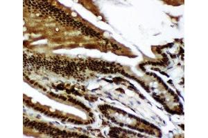 IHC-P: p73 antibody testing of mouse intestine tissue (Tumor Protein p73 抗体  (AA 1-198))
