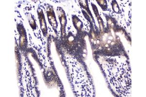 IHC analysis of DGCR8 using anti-DGCR8 antibody (ABIN5692841). (DGCR8 抗体  (AA 561-762))