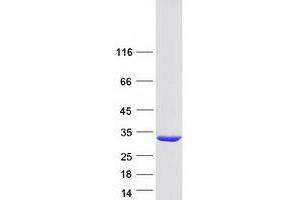 Western Blotting (WB) image for Glutathione S-Transferase mu 5 (GSTM5) protein (Myc-DYKDDDDK Tag) (ABIN2722278)