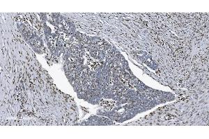 IHC analysis of SAMHD1 using anti-SAMHD1 antibody (ABIN7601514).