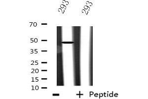Western blot analysis of extracts from 293 cells using CSTF1 antibody. (CSTF1 抗体  (N-Term))