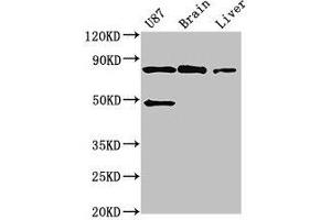 Western Blot Positive WB detected in: U87 whole cell lysate, Mouse brain tissue, Mouse liver tissue All lanes: GARS antibody at 3 μg/mL Secondary Goat polyclonal to rabbit IgG at 1/50000 dilution Predicted band size: 84 kDa Observed band size: 84 kDa (GARS 抗体  (AA 1-389))