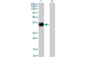 Western Blot analysis of CTSZ expression in transfected 293T cell line by CTSZ MaxPab polyclonal antibody. (Cathepsin Z 抗体  (AA 1-303))