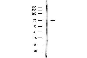Western blot analysis of lysates from PC12 cells(starvation,24h treatment), using Phospho-p70 S6 Kinase (Ser424)[Ser447] Antibody at 1/1000 dilution.