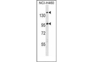 Western blot analysis of SSC5D Antibody  in NCI-H460 cell line lysates (35ug/lane). (SSC5D 抗体  (Middle Region))