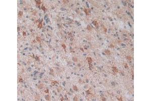 Figure. (LPCAT3 抗体  (AA 122-233))