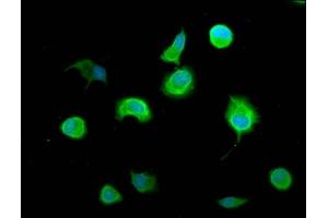 Immunofluorescence staining of MCF-7 cells with ABIN7143405 at 1:100, counter-stained with DAPI. (AEBP1 抗体  (AA 46-234))