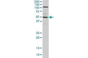 SYT4 monoclonal antibody (M04A), clone 5F8 Western Blot analysis of SYT4 expression in A-431 . (SYT4 抗体  (AA 1-99))
