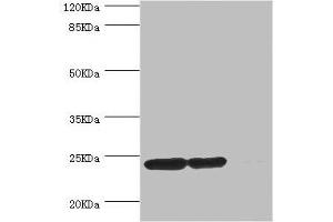 Western blot All lanes: DTYMK antibody at 5. (DTYMK 抗体  (AA 1-212))