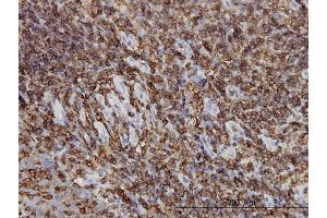 Immunoperoxidase of monoclonal antibody to HCLS1 on formalin-fixed paraffin-embedded human tonsil. (HCLS1 抗体  (AA 266-355))