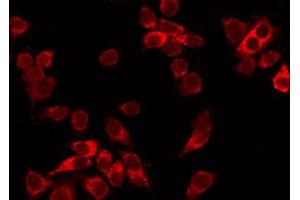 Immunofluorescence (fixed cells) (IF/ICC) image for anti-Cyclin-Dependent Kinase 1 (CDK1) (N-Term) antibody (ABIN6260670)
