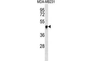 YAP Antibody western blot analysis in MDA-MB231 cell line lysates (35 µg/lane). (YAP1 抗体  (Middle Region))