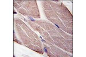 Formalin-fixed and paraffin-embedded human skeletal muscle tissue reacted with PDK4, which was peroxidase-conjugated to the secondary antibody, followed by DAB staining. (PDK4 抗体  (Middle Region))