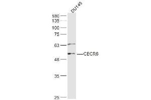 DU145 lysates probed with CECR6 Polyclonal Antibody, Unconjugated  at 1:500 dilution and 4˚C overnight incubation. (CECR6 抗体)