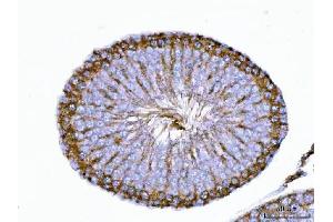 IHC analysis of TRBP/TARBP2 using anti-TRBP/TARBP2 antibody (ABIN7600548).