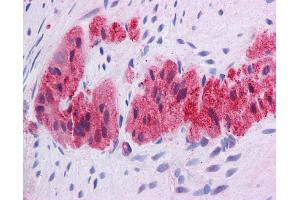 Immunohistochemistry (IHC) image for anti-Kruppel-Like Factor 2 (Lung) (KLF2) (Middle Region) antibody (ABIN2777573)