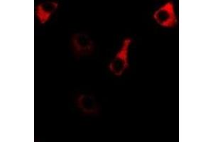 Immunofluorescent analysis of RPS14 staining in MCF7 cells. (RPS14 抗体)