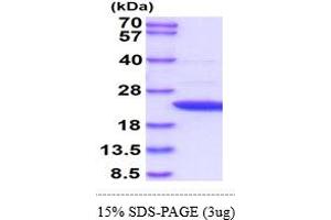 SDS-PAGE (SDS) image for Adenine Phosphoribosyltransferase (APRT) (AA 1-180) protein (ABIN666946)