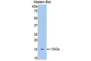 Western Blotting (WB) image for anti-Slit Homolog 2 (Drosophila) (SLIT2) (AA 1416-1528) antibody (ABIN1860579) (SLIT2 抗体  (AA 1416-1528))