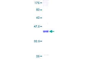 PMS1 Protein (AA 1-166) (GST tag)