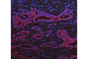 IF analysis of Cytokeratin 19 using anti-Cytokeratin 19 antibody (ABIN3043288). (Cytokeratin 19 抗体  (C-Term))
