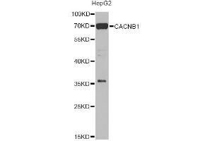 Western blot analysis of extracts of HepG2 cells, using CACNB1 Antibody (ABIN5975152) at 1/1000 dilution. (CACNB1 抗体)