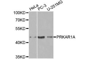 Western Blotting (WB) image for anti-Protein Kinase, CAMP-Dependent, Regulatory, Type I, alpha (Tissue Specific Extinguisher 1) (PRKAR1A) (AA 1-250) antibody (ABIN3021148)